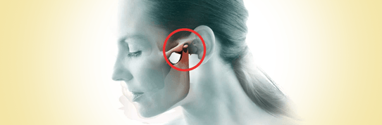 body-tmj What is TMJ disorder or TMD in Dickson, TN | Accent Smile Center