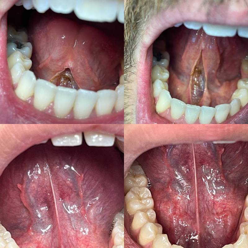 Dental Implants Dickson TN