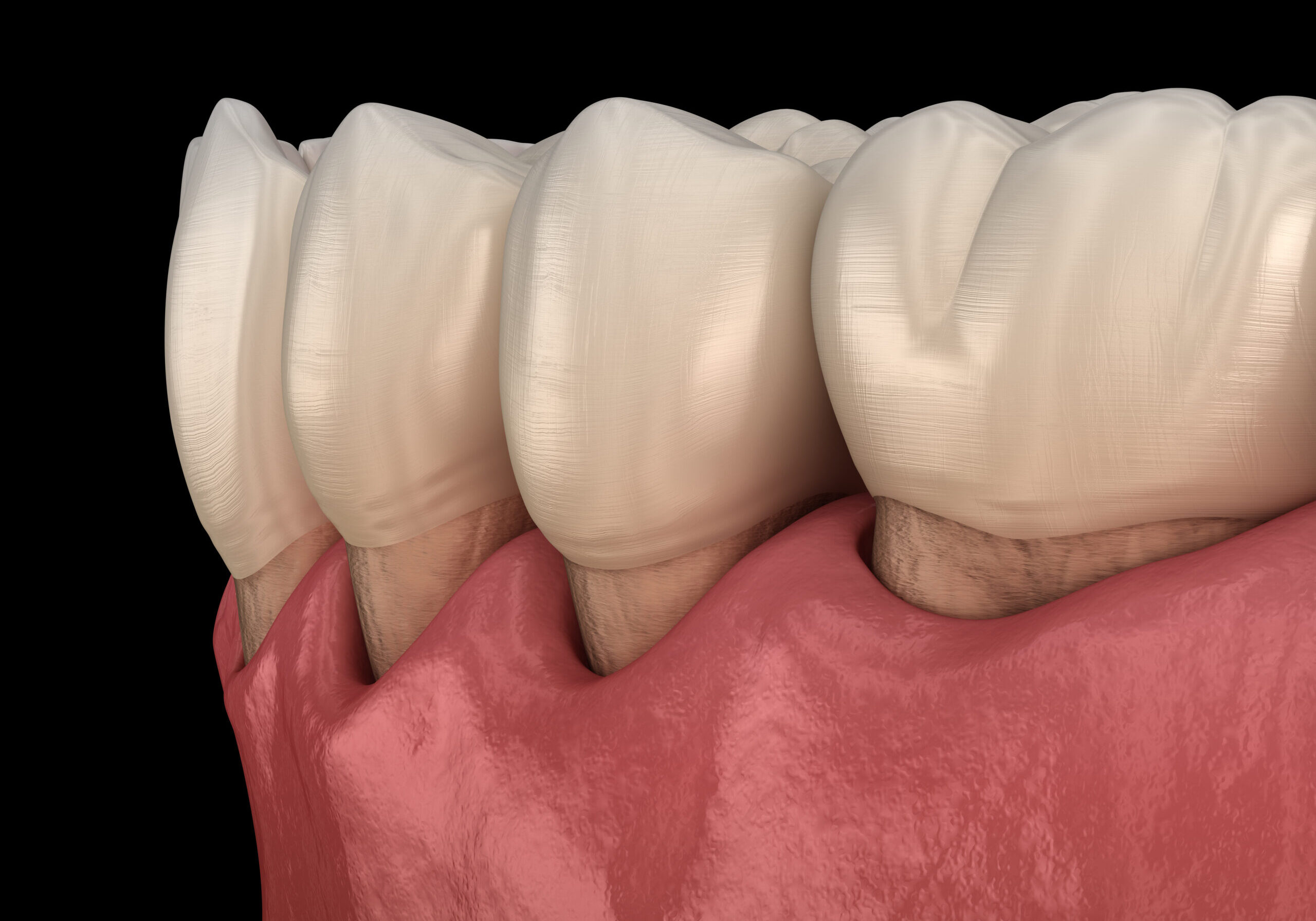 Restorative Dentistry Dickson